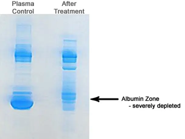 AlbuSorb™ - Albumin Depletion Kit - 20 preps (25 µL serum samples)