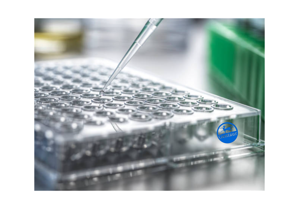 ELISA   ABCD1 anti-
